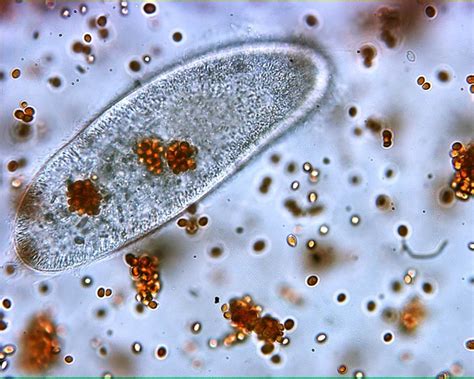  Paramecium: Bu Küçük Yaratıkların Dünyası Sizi Şaşırtacak!